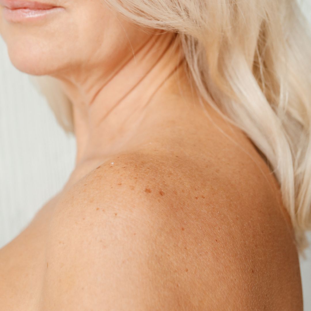 7 Myths About Removing Age Spots and Sunspots (And What Actually Works)